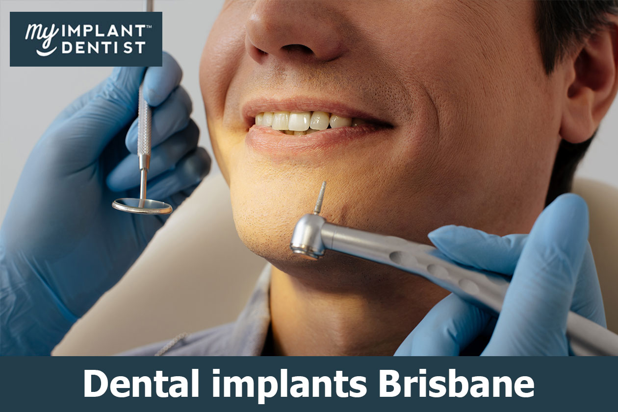 Dental Implants Are Usually  Made From Titanium  And Also Are Placed Into The Jawbone